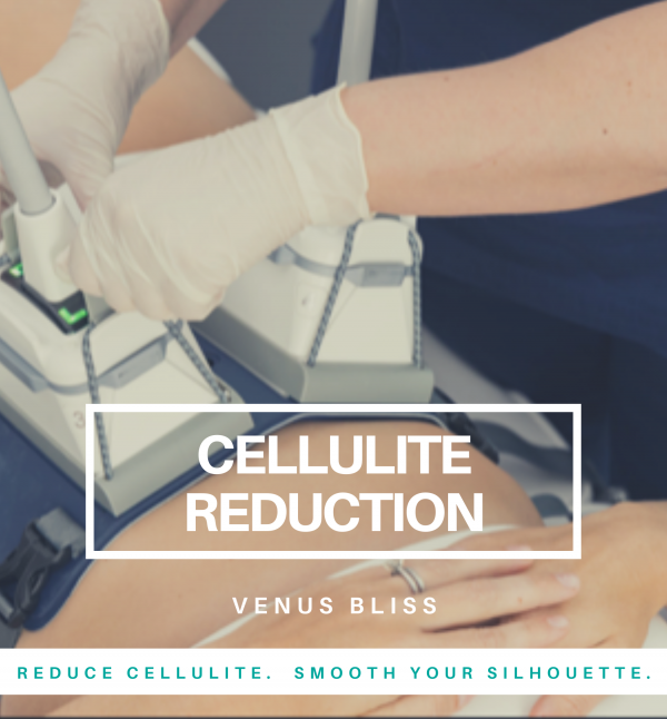 Cellulite Reduction by Venus Bliss™ Package